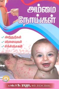 அம்மை நோய்கள் - அறிகுறிகள் விளைவுகள் சிகிச்சைகள்